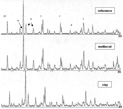 AZoJomo - AZO Journal of Mater亚博网站下载ials Online - Composition 1在18h内烧结至1450°C，加入甲基纤维素和粘土，负载13350 N， (B-badeleyite, C-刚玉，q -石英，zs -锆石，m -莫来石)。